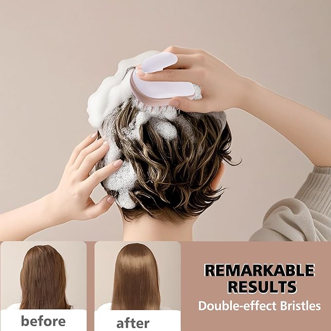 Scalp Massager Shampoo Brush,Scalp Scrubber,Exfoliator for Removing Dandruff & Hair Growth,Detangling Scrubber for All Hair(WhiteBrown)
