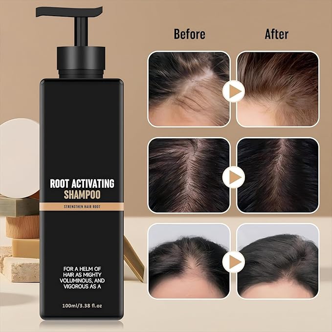 Root Activator Shampoo– Anti Hair Loss Treatment | Reduces Shedding, With Natural Regrowth Formula | Thickening & Nourishing For All Hair| Reduce Shedding,Smooths Hair, 2PCS
