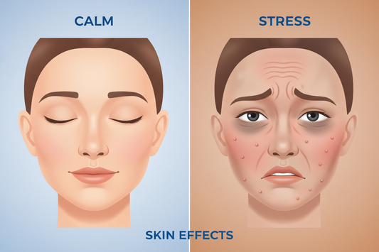 😰 How Stress Affects Your Skin