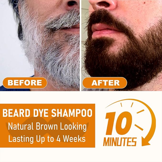 Men’s Brown Beard Dye for Men, 3 in 1 Dark Brown Hair Dye Shampoo for Grey Facial Hair Coverage, 10 Mins Instant Color for Beard, Mustache & Hair, Long-Lasting Beard Color With Natural Extract, 200ML