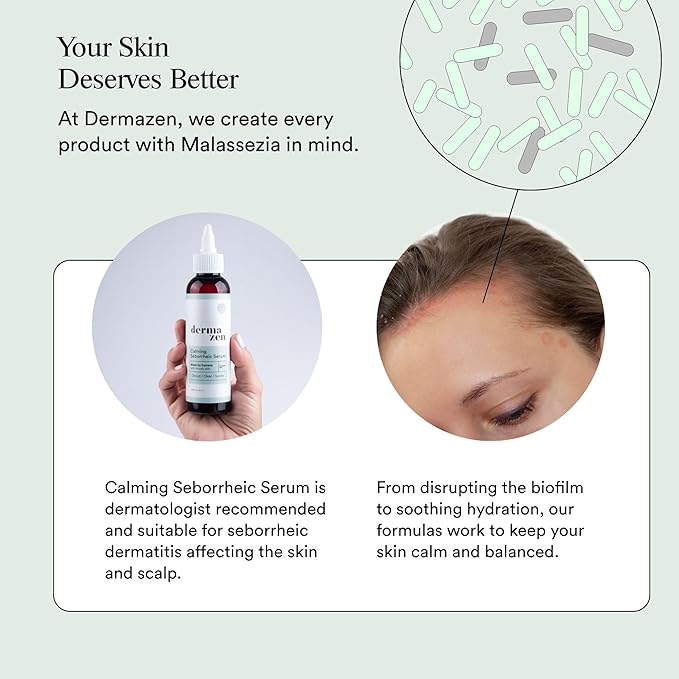 Calming Seborrheic Serum, Dermatologist Recommended, Topical Seborrheic Dermatitis Serum For Scalp, Face, and Body (8 fl oz)