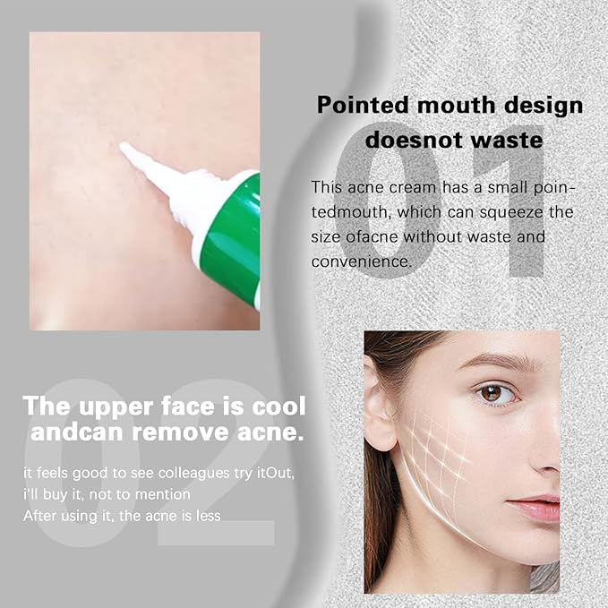 Niacinamide Soothing Cream – Lightweight Hydrating & Calming Moisturizer with Niacinamide, Aloe & Hyaluronic Acid for Face & Body (20g | 1-Pack)