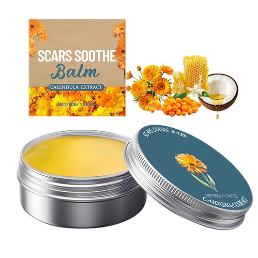 Daily Use Acne Care Balm with Calendula & Herbal Blend to Soothe Skin, Fade Imperfections, Lightweight Moisturizer for Oily & Sensitive Skin