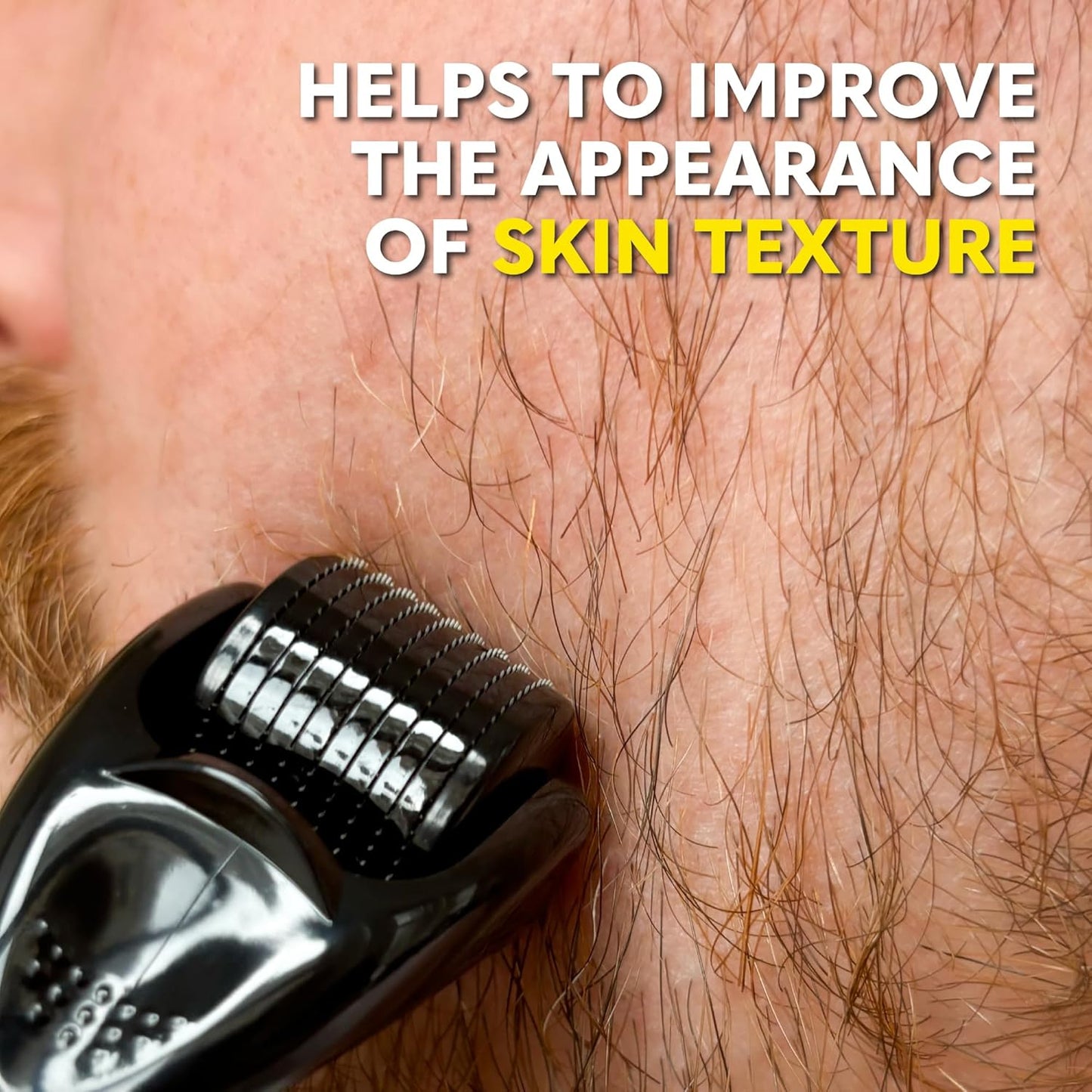 The Beard Club Derma Roller for Face, Body and Scalp - Microneedling for Men and Women with 540 Titanium Microneedles - Beard Roller & Micro Needling Scalp Hair - Gray & Black