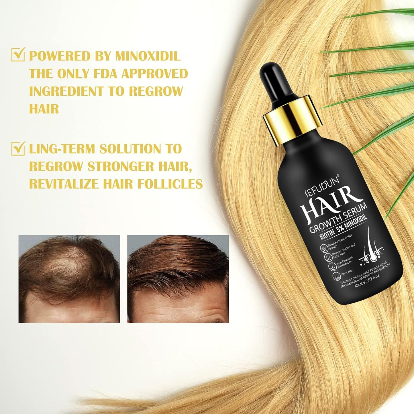 2Pack 5% Minoxidil for Men & Women, Minoxidil for Women Hair Growth, Minoxidil for Men Beard, Natural Hair Regrowth Treatment for Hair Loss Hair Thinning, Thicker Fuller Healthier Hair