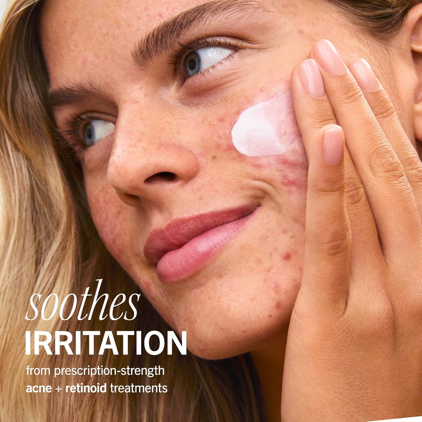 First Aid Beauty - Ultra Repair Rescue Barrier Balm, Deep Hydrating Skin Barrier Mask with 1% Dimethicone, Visible 24-Hour Relief for Dry, Cracked & Chapped Skin, Safe for Sensitive Skin, 2.25 oz