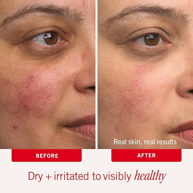 First Aid Beauty - Ultra Repair Cream - Intense Hydration Face & Body Moisturizer - Whipped Colloidal Oatmeal Clinically Proven to Strengthen Skin Barrier in 7 Days - Helps Relieve Eczema, 4 oz