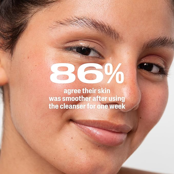 Cetaphil Gentle Clear Complexion-Clearing BPO Acne Cleanser with 2.6% Benzoyl Peroxide, Creamy and Soothing for Sensitive Skin, Suitable for All Skin Types, 4.2oz