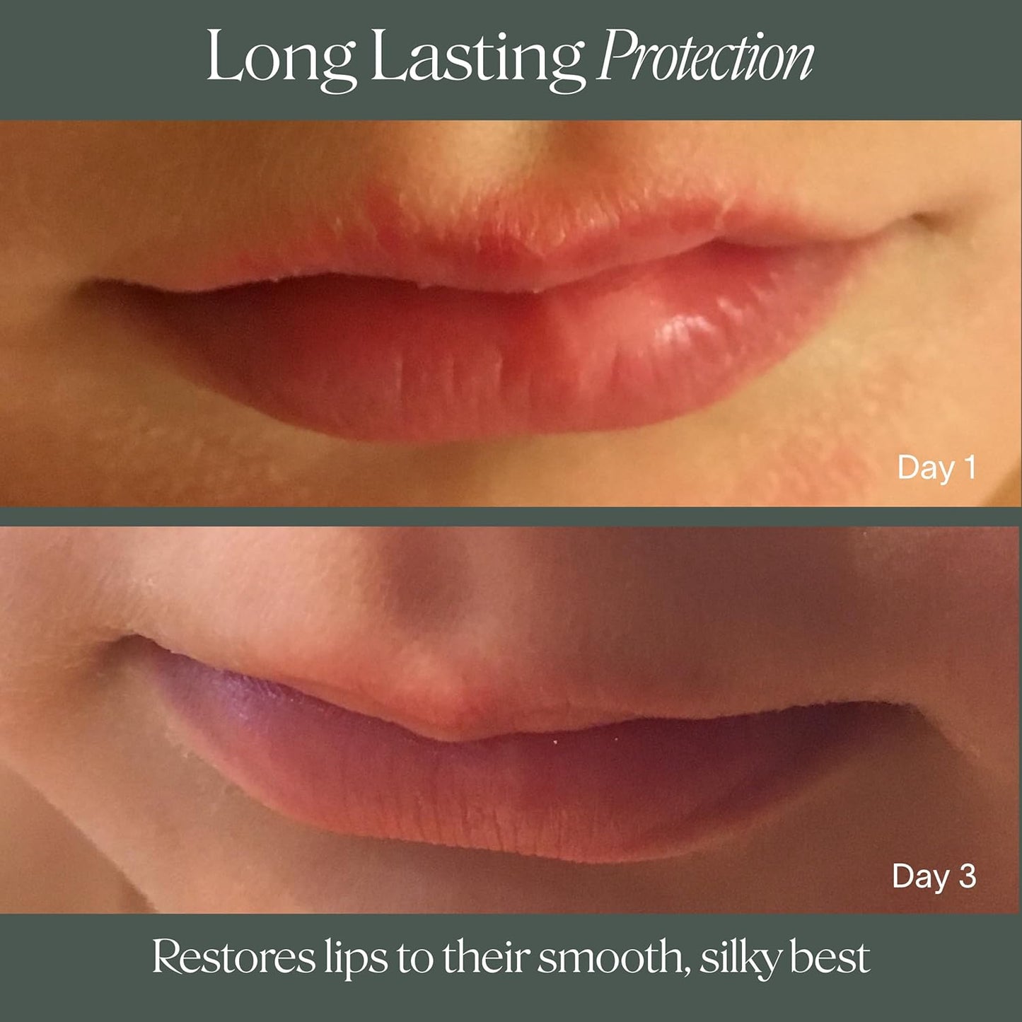 Doctor Rogers Lip Balm. Hydrating & Softening Lip Moisturizer for Very Dry Lips, Natural & Hypoallergenic, 0.15 Ounce (4.25 g) Tube